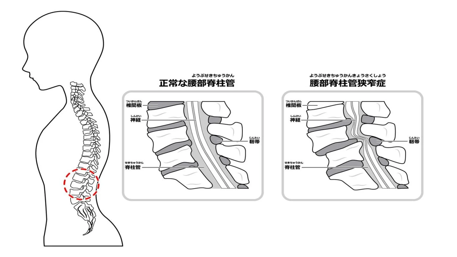姿勢の状態イメージ